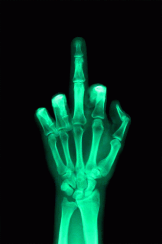 yes-middle-finger.gif.aeea83b5daa82f08533056f8f18580a4.gif